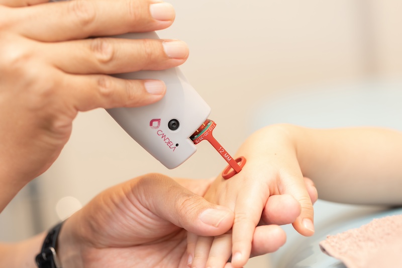 治療後の注意点