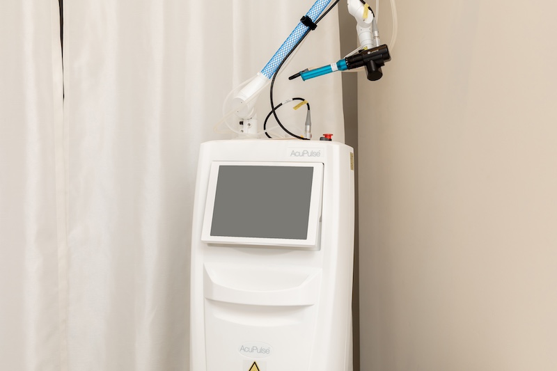 アキュパルスとは？