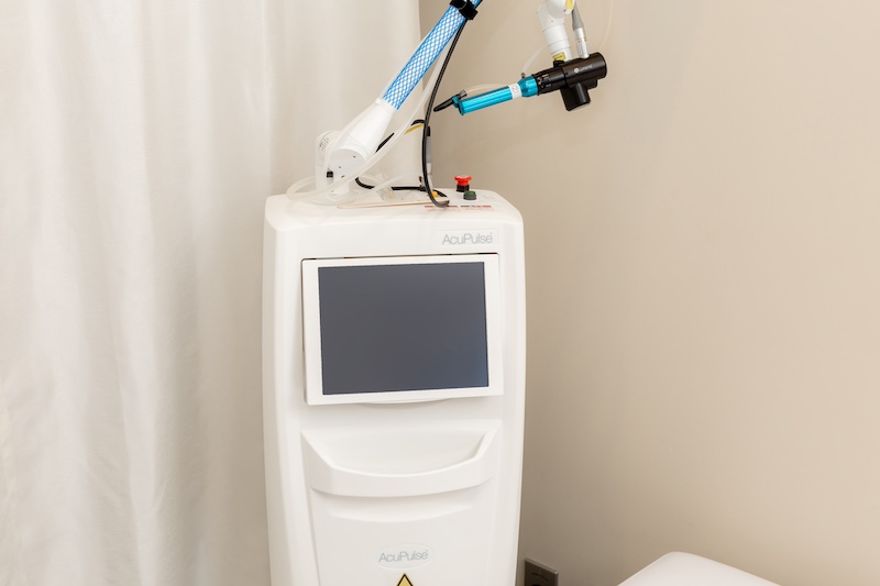 アキュパルス（CO2レーザー）