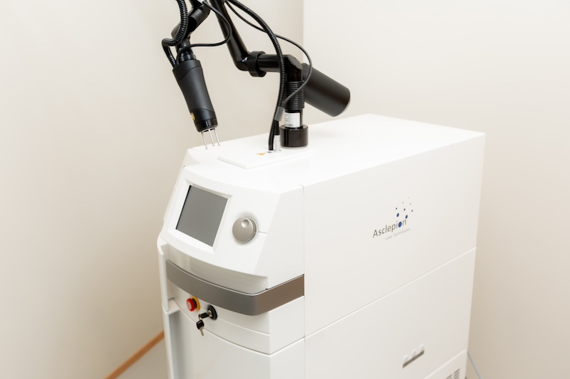 ナノスターR（Qスイッチルビーレーザー）