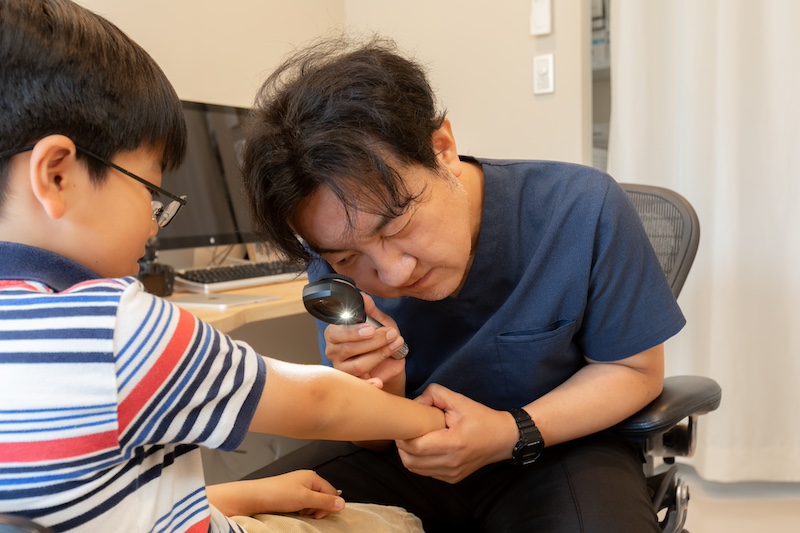 子供のあざについて